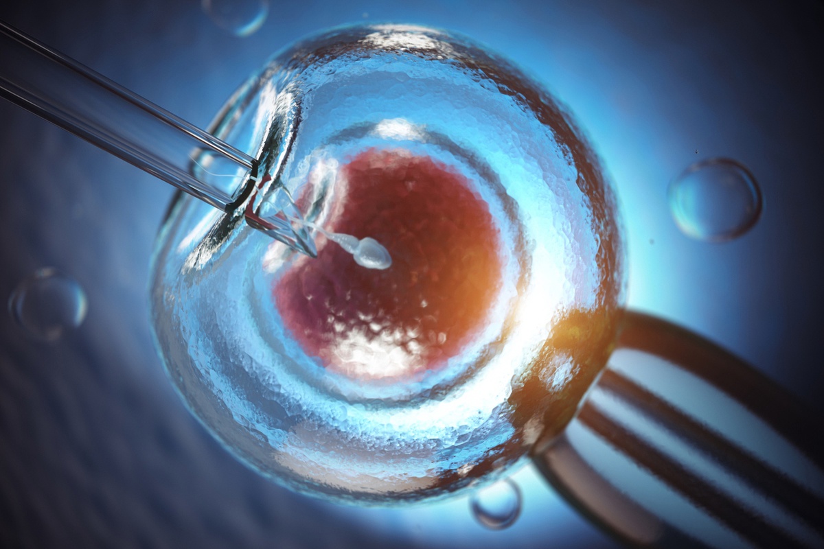 Интрацитоплазматическая инъекция сперматозоида в яйцеклетку (ИКСИ) — Будут Дети